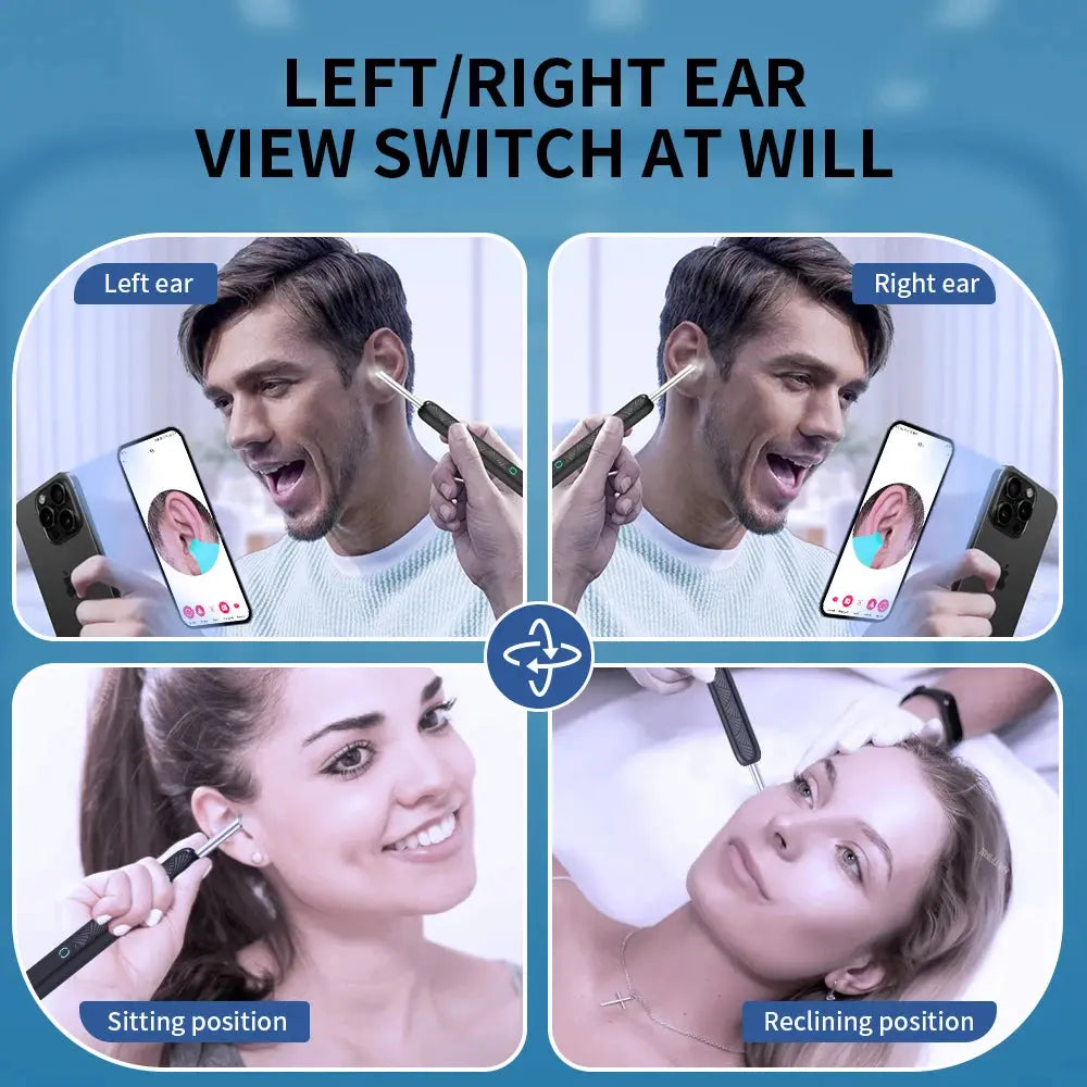 Ear Cleaner with Camera Wireless Ear Sticks Otoscope USB C Charging Endoscope Wax Removal Tool Earpick MIni Camera